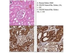 CH25H Antibody, Novus Biologicals 50 &mu;g; Unconjugated:Antibodies, Polyclonal