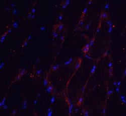 CHADL Antibody - BSA Free, Novus Biologicals 0.1 mg; Unconjugated:Antibodies,
