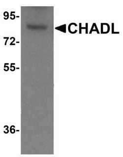 CHADL Antibody - BSA Free, Novus Biologicals 0.1 mg; Unconjugated:Antibodies,