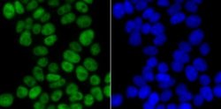 CHAF1B Rabbit anti-Human, Clone: JG92-30, Novus Biologicals 100 &mu;L | Buy Online | Novus Biologicals | Fisher Scientific
