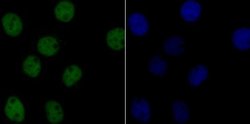 CHAF1B Rabbit anti-Human, Clone: JG92-30, Novus Biologicals 100 &mu;L | Buy Online | Novus Biologicals | Fisher Scientific