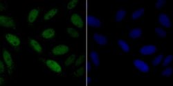 CHAF1B Rabbit anti-Human, Clone: JG92-30, Novus Biologicals 100 &mu;L | Buy Online | Novus Biologicals | Fisher Scientific
