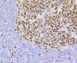 CHAF1B Rabbit anti-Human, Clone: JG92-30, Novus Biologicals 100 &mu;L | Buy Online | Novus Biologicals | Fisher Scientific