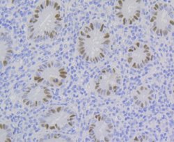 CHAF1B Rabbit anti-Human, Clone: JG92-30, Novus Biologicals 100 &mu;L | Buy Online | Novus Biologicals | Fisher Scientific