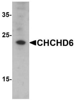 CHCHD6 Antibody - BSA Free, Novus Biologicals 0.1 mg | Buy Online | Novus Biologicals | Fisher Scientific