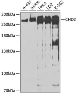 CHD2 Antibody - BSA Free, Novus Biologicals 0.1 mL, Unconjugated:Antibodies,