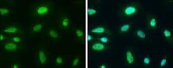 CHD3 Antibody, Novus Biologicals 100 μg; Unconjugated:Antibodies, Polyclonal