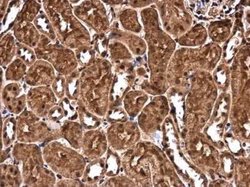 CHD3 Antibody, Novus Biologicals 100 μg; Unconjugated:Antibodies, Polyclonal