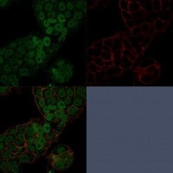 CHD4 Antibody (3F2/4) - Azide and BSA Free, Novus Biologicals 100 &mu;g | Buy Online | Novus Biologicals | Fisher Scientific