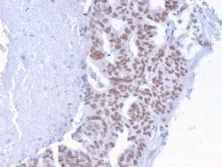 CHD4 Mouse anti-Human, Mouse, Clone: 3F2/4, Novus Biologicals 20 &mu;g;
