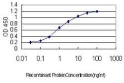 CHD4 Antibody (4H4), Novus Biologicals 100 &mu;g | Buy Online | Novus Biologicals | Fisher Scientific
