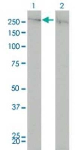 CHD4 Antibody (4H4), Novus Biologicals 100 &mu;g | Buy Online | Novus Biologicals | Fisher Scientific