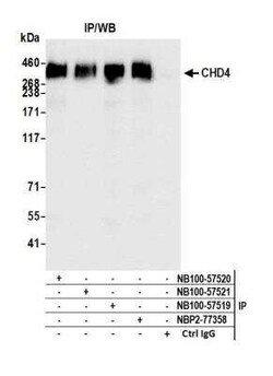 CHD4 Antibody (BLR066G), Novus Biologicals 100 &mu;g | Buy Online | Novus Biologicals | Fisher Scientific