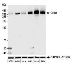 CHD4 Antibody (BLR066G), Novus Biologicals 100 &mu;g | Buy Online | Novus Biologicals | Fisher Scientific