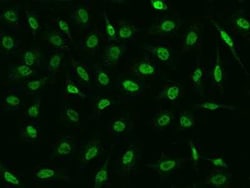 CHD4 Antibody, Novus Biologicals 100 &mu;g, Unconjugated:Antibodies, Polyclonal