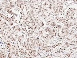 CHD4 Antibody, Novus Biologicals:Antibodies:Primary Antibodies
