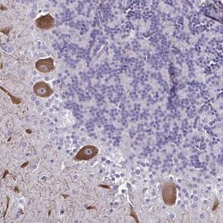 CHD5 Antibody, Novus Biologicals 25 &mu;L, Unconjugated:Antibodies, Polyclonal