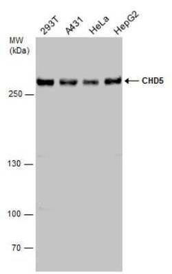 CHD5 Antibody, Novus Biologicals 100 &mu;g; Unconjugated:Antibodies, Polyclonal