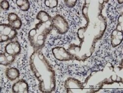 CHFR Antibody (1H3-A12), Novus Biologicals 0.1 mg | Buy Online | Novus Biologicals | Fisher Scientific