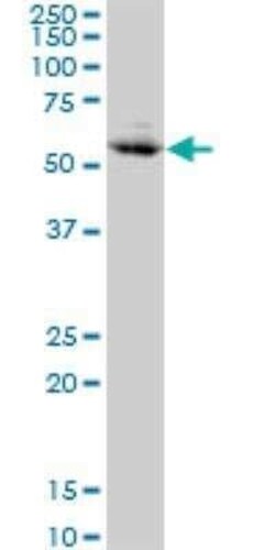 CHFR Antibody (1H3-A12), Novus Biologicals 0.1 mg | Buy Online | Novus Biologicals | Fisher Scientific