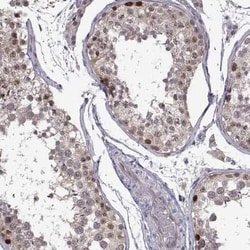 CHFR Antibody, Novus Biologicals 25ul; Unconjugated:Antibodies, Polyclonal