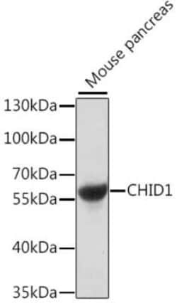 CHID1 Antibody - Azide and BSA Free, Novus Biologicals 0.1 mL, Unconjugated:Antibodies,