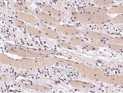 CHIP/STUB1 Rabbit anti-Human, Clone: 6, Novus Biologicals 50 &mu;g; Unconjugated:Antibodies,