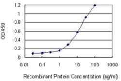 CHIP/STUB1 Antibody (2E12), Novus Biologicals 0.1 mg | Buy Online | Novus Biologicals | Fisher Scientific