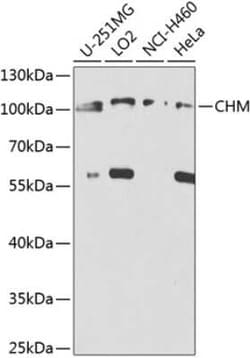 CHM Antibody - BSA Free, Novus Biologicals:Antibodies:Primary Antibodies