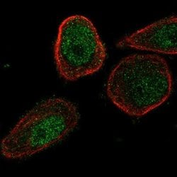CHML Antibody, Novus Biologicals:Antibodies:Primary Antibodies