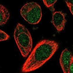 CHML Antibody, Novus Biologicals CHML Antibody; Unconjugated; 100 &mu;L:Antibodies,