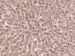 CHMP2A Antibody, Novus Biologicals 50 &mu;g, Unconjugated:Antibodies, Polyclonal
