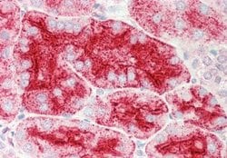 CHMP4B Antibody, Novus Biologicals 100 &mu;L; Unconjugated:Antibodies,