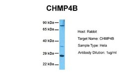 CHMP4B Antibody, Novus Biologicals 100 &mu;L; Unconjugated:Antibodies,