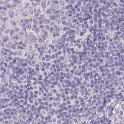 CHMP5 Antibody, Novus Biologicals:Antibodies:Primary Antibodies