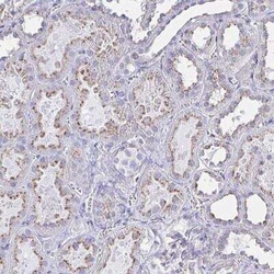 CHMP5 Antibody, Novus Biologicals 25 &mu;L, Unconjugated:Antibodies, Polyclonal
