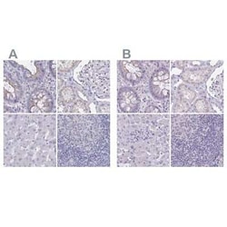 CHMP5 Antibody, Novus Biologicals 25 &mu;L, Unconjugated:Antibodies, Polyclonal
