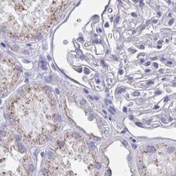 CHMP5 Antibody, Novus Biologicals 25 &mu;L, Unconjugated:Antibodies, Polyclonal