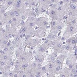 CHMP5 Antibody, Novus Biologicals 25 &mu;L, Unconjugated:Antibodies, Polyclonal