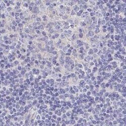 CHMP5 Antibody, Novus Biologicals 25 &mu;L, Unconjugated:Antibodies, Polyclonal