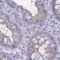 CHMP5 Antibody, Novus Biologicals 25 &mu;L, Unconjugated:Antibodies, Polyclonal