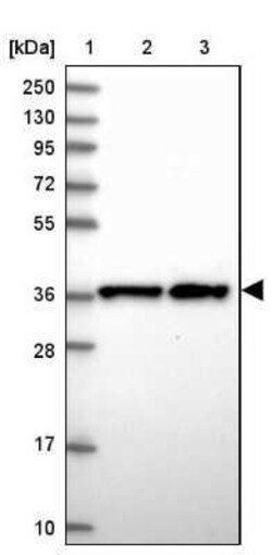 CHORDC1 Antibody, Novus Biologicals 25 &mu;L | Buy Online | Novus Biologicals | Fisher Scientific