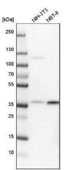 CHORDC1 Antibody, Novus Biologicals 25 &mu;L | Buy Online | Novus Biologicals | Fisher Scientific