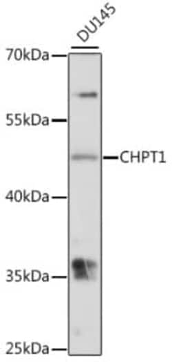 CHPT1 Antibody - Azide and BSA Free, Novus Biologicals 0.02 mL, Unconjugated:Antibodies,