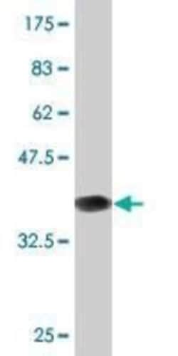 CHRNB3 Antibody (3G6), Novus Biologicals 0.1 mg | Buy Online | Novus Biologicals | Fisher Scientific