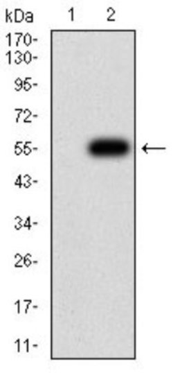 CHRND Antibody (1H1F9) - BSA Free, Novus Biologicals:Antibodies:Primary