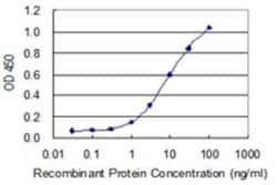 Novus Biologicals CHRND Antibody (2B2), Novus Biologicals 0.1 mg | Buy Online | Novus Biologicals&trade; | Fisher Scientific
