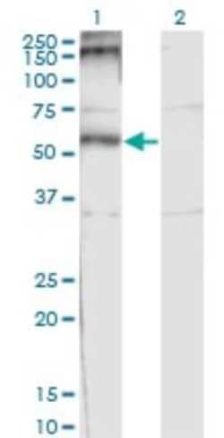 Novus Biologicals CHRND Antibody (2B2), Novus Biologicals 0.1 mg | Buy Online | Novus Biologicals&trade; | Fisher Scientific