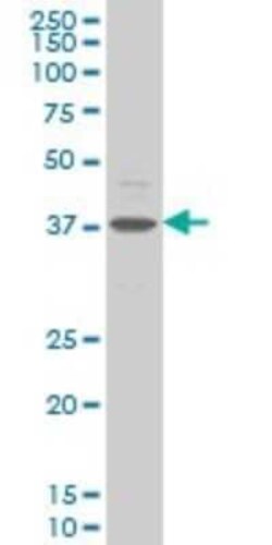 Novus Biologicals CHST11 Antibody (4F1), Novus Biologicals 0.1 mg | Buy Online | Novus Biologicals&trade; | Fisher Scientific