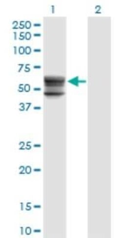 CHST12 Antibody (3D6), Novus Biologicals 0.1 mg, Unconjugated:Antibodies,